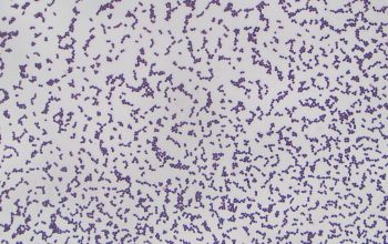 Rhodococcus equi  (Prescottella equi) Gram stain