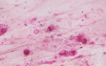 Rhodococcus equi  (Prescottella equi) Gram stain