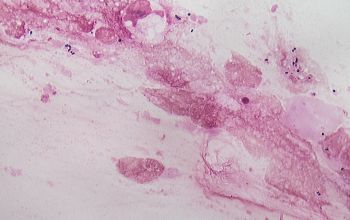 Rhodococcus equi  (Prescottella equi) Gram stain