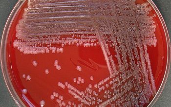 Rothia mucilaginosa Blood Agar 48h culture incubated with CO2