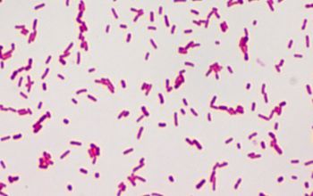 Salmonella manhattan (Salmonella enterica subsp. enterica serovar Manhattan) 