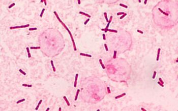 Salmonella typhi (Salmonella enterica subsp. enterica serovar Typhi) Gram stain