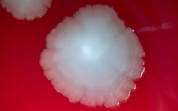 Salmonella typhimurium (Salmonella enterica subsp. enterica serovar Typhimurium) Blood Agar 48h culture incubated with O2