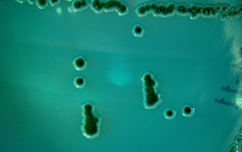 Salmonella typhimurium (Salmonella enterica subsp. enterica serovar Typhimurium)  culture incubated with O2