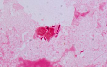 Serratia marcescens Gram stain