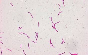 Sphingobacterium spiritivorum Gram stain