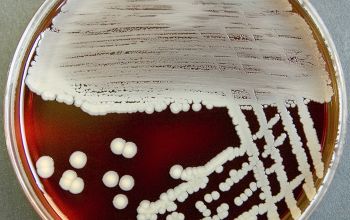 Staphylococcus aureus Blood Agar 48h culture incubated with O2