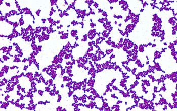 Staphylococcus aureus Gram stain