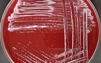 Staphylococcus auricularis Blood Agar 24h culture incubated with CO2