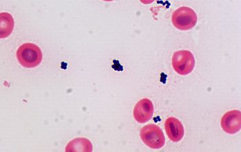 Staphylococcus auricularis Gram stain