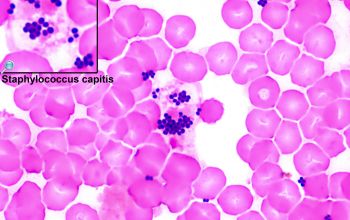 Staphylococcus capitis subsp capitis Gram stain