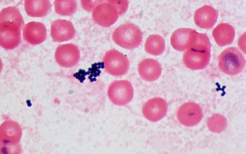 Staphylococcus caprae Gram stain