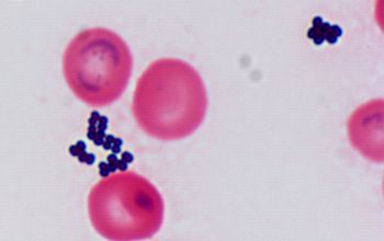 Staphylococcus epidermidis Gram stain