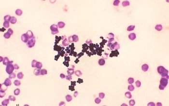 Staphylococcus haemolyticus Gram stain
