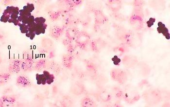 Staphylococcus haemolyticus Gram stain