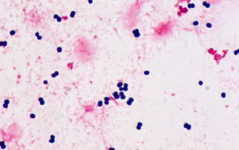 Staphylococcus hominis Gram stain