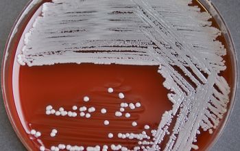 Staphylococcus intermedius Blood Agar 24h culture incubated with CO2