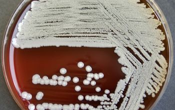 Staphylococcus intermedius Blood Agar 48h culture incubated with CO2