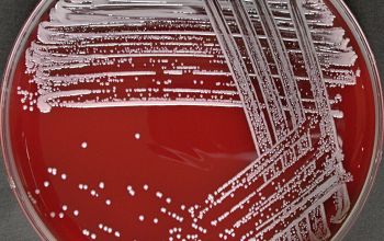 Staphylococcus lugdunensis Blood Agar 24h culture incubated with CO2
