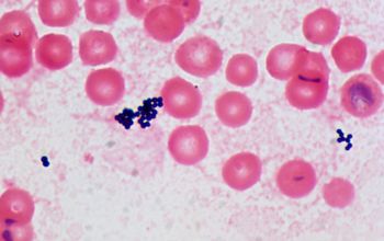 Staphylococcus saprophyticus Gram stain