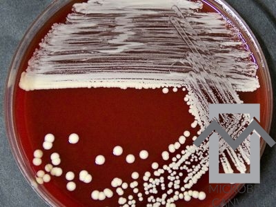 Staphylococcus Saprophyticus