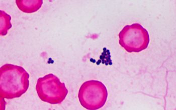 Staphylococcus schleiferi Gram stain