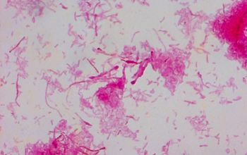 Streptobacillus moniliformis Gram stain