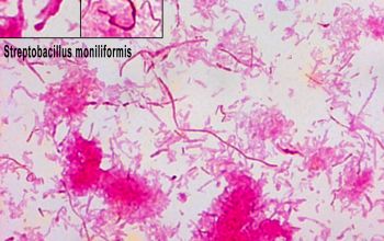 Streptobacillus moniliformis Gram stain