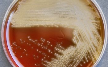 Streptococcus acidominimus Blood Agar 48h culture incubated with CO2