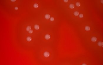 Streptococcus acidominimus Blood Agar 48h culture incubated with CO2