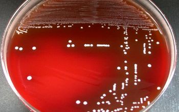 Streptococcus agalactiae Blood Agar 48h culture incubated with CO2