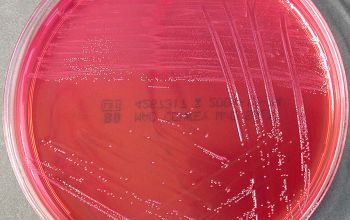 Streptococcus agalactiae Mac Conkey Agar without salt 24h culture incubated with CO2