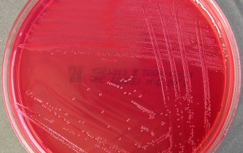 Streptococcus agalactiae Mac Conkey Agar without salt 48h culture incubated with CO2