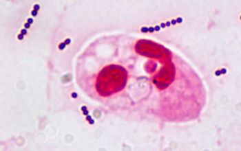 Streptococcus agalactiae Gram stain