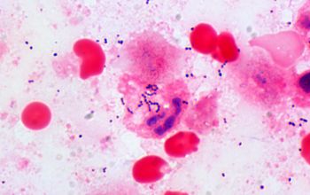 Streptococcus anginosus Gram stain