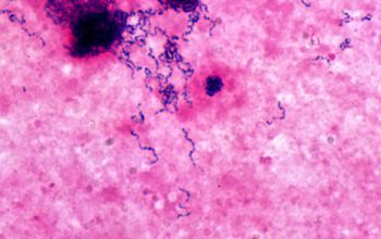 Streptococcus anginosus Gram stain