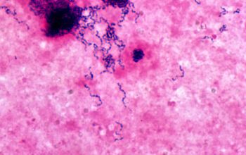 Streptococcus constellatus Gram stain
