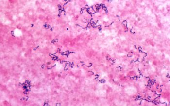 Streptococcus constellatus Gram stain