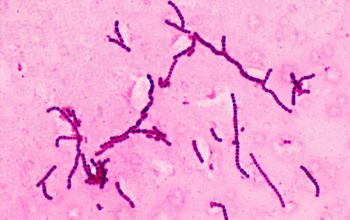 Streptococcus dysgalactiae ssp equisimilis Gram stain