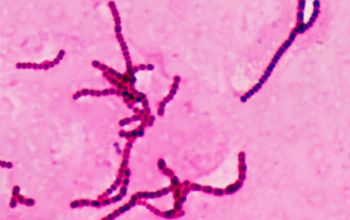 Streptococcus dysgalactiae ssp equisimilis Gram stain