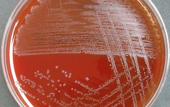 Streptococcus gallolyticus Blood Agar 48h culture incubated with CO2