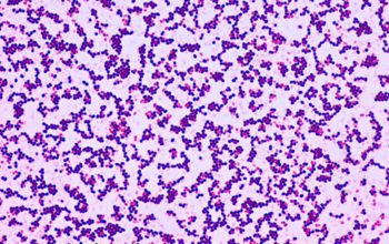Streptococcus gallolyticus Gram stain