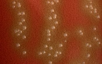 Streptococcus gordonii Chocolate Agar 24h culture incubated with CO2