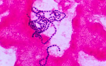 Streptococcus gordonii Gram stain