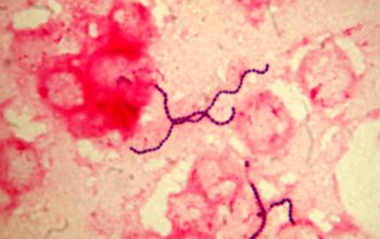Streptococcus intermedius Gram stain