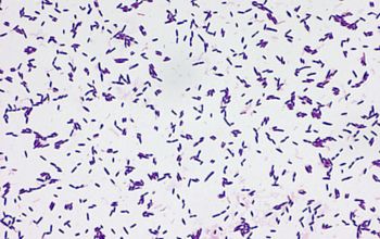 Streptococcus mutans Gram stain