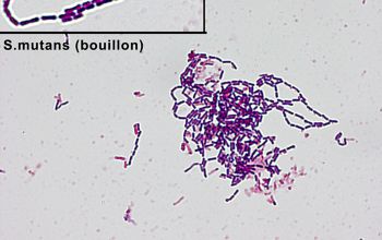Streptococcus mutans Gram stain
