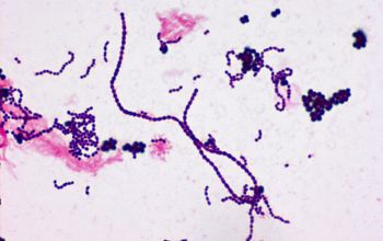 Streptococcus oralis Gram stain