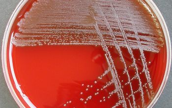 Streptococcus oralis Blood Agar 24h culture incubated with CO2