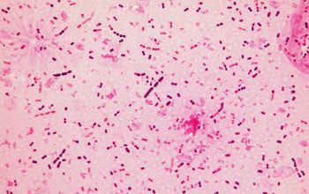 Streptococcus pneumoniae Gram stain